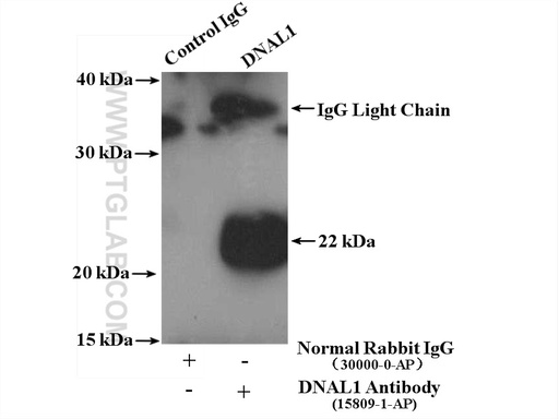 [15809-1-AP-20UL] DNAL1 Polyclonal antibody