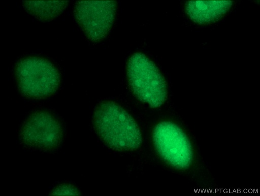 [15810-1-AP-150UL] ANP32A Polyclonal antibody