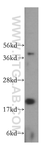 [15811-1-AP-20UL] Centrin 3 Polyclonal antibody