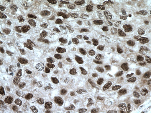 [15817-1-AP-20UL] XRCC4 Polyclonal antibody