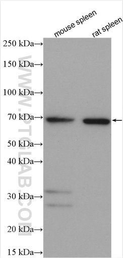 [15819-1-AP-150UL] RHAMM,Lgals9 Polyclonal antibody