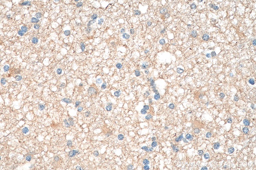[15821-1-AP-20UL] PKM1-specific Polyclonal antibody