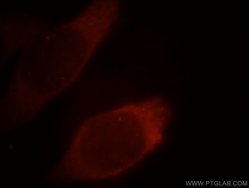 [15822-1-AP-20UL] PKM2-specific Polyclonal antibody