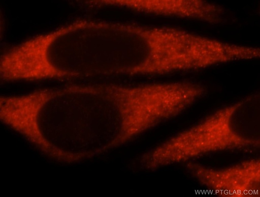 [15823-1-AP-20UL] UBASH3A-Specific Polyclonal antibody