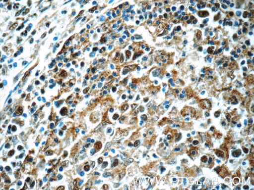 [15825-1-AP-150UL] MCL1L-specific Polyclonal antibody
