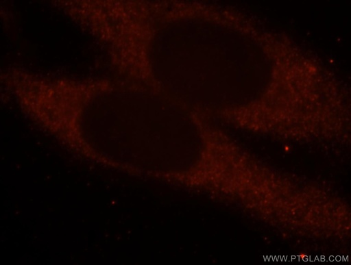 [15826-1-AP-20UL] domain-I-of-FIZ-1 Polyclonal antibody
