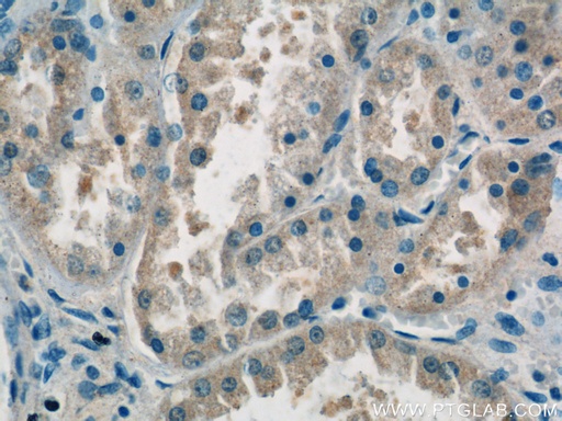 [15827-1-AP-150UL] domain-II-of-FIZ1 Polyclonal antibody