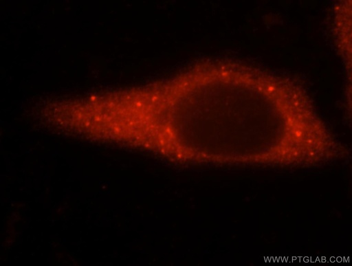 [15831-1-AP-20UL] GARS Polyclonal antibody