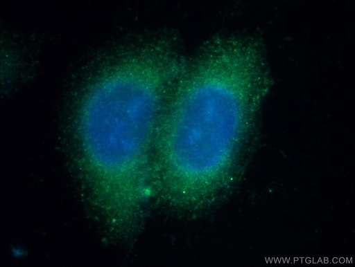 [15837-1-AP-20UL] C4BPB Polyclonal antibody