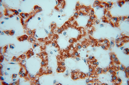 [15838-1-AP-150UL] GSTT1 Polyclonal antibody