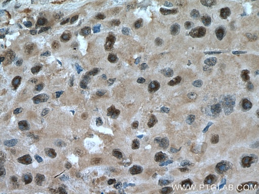 [15839-1-AP-150UL] PSMC6 Polyclonal antibody