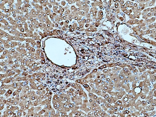 [15841-1-AP-20UL] Fibrinogen Gamma Chain Polyclonal antibody