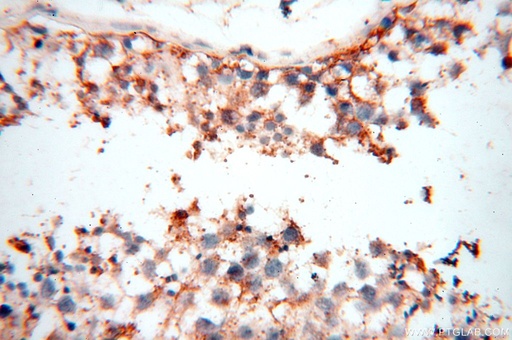[15847-1-AP-150UL] TGM4 Polyclonal antibody