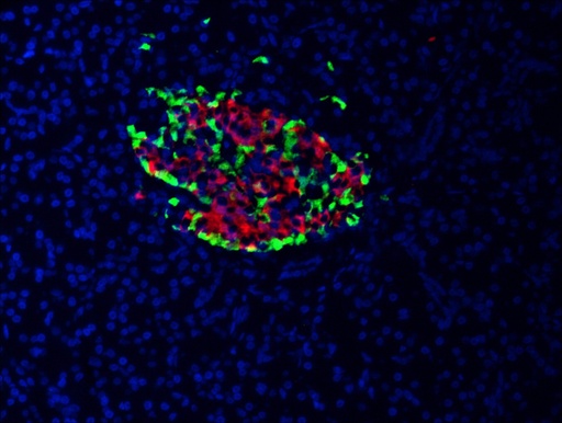 [15848-1-AP-20UL] INS Polyclonal antibody