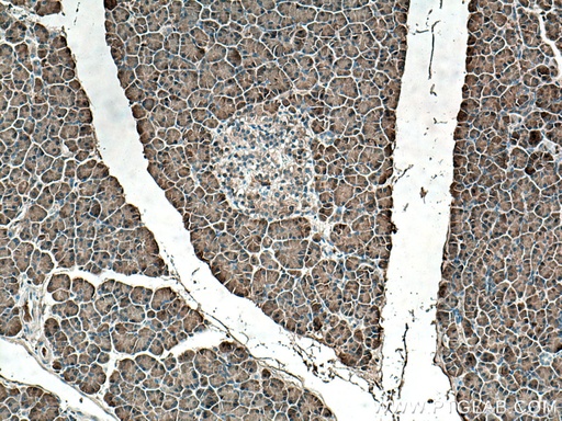 [15850-1-AP-20UL] REG Polyclonal antibody