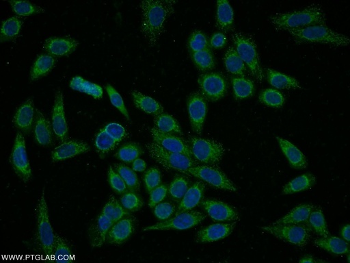 [15851-1-AP-20UL] PYGL Polyclonal antibody