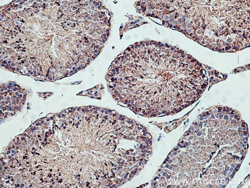 [15852-1-AP-20UL] PPP6C Polyclonal antibody