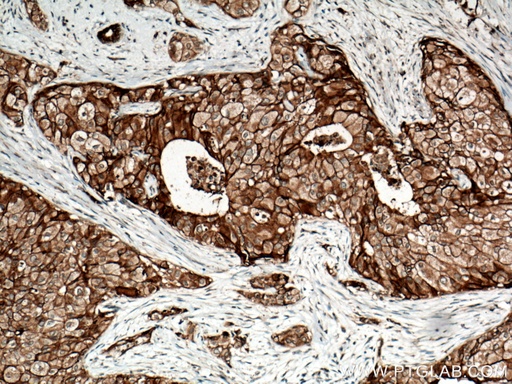 [15853-1-AP-20UL] FXYD3 Polyclonal antibody
