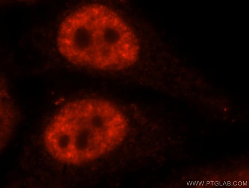 [15858-1-AP-20UL] SF3A1 Polyclonal antibody