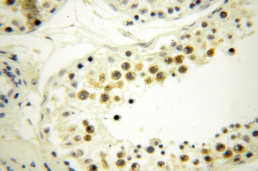 [15859-1-AP-150UL] BTBD1 Polyclonal antibody
