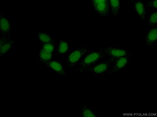 [15867-1-AP-20UL] THYN1 Polyclonal antibody