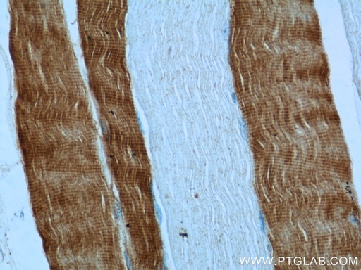 [15875-1-AP-20UL] TNNC2 Polyclonal antibody