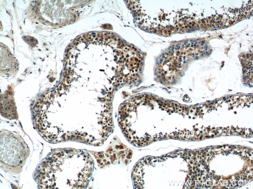 [15876-1-AP-20UL] SSX4 Polyclonal antibody