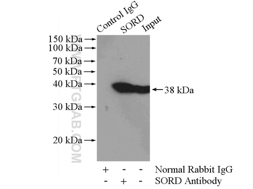 [15881-1-AP-150UL] Sorbitol dehydrogenase Polyclonal antibody