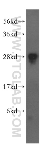 [15884-1-AP-20UL] FKBP14 Polyclonal antibody