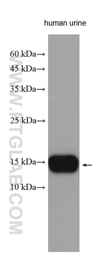 [15888-1-AP-150UL] MSMB Polyclonal antibody