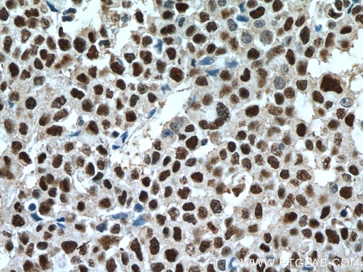 [15912-1-AP-150UL] UBE1 Polyclonal antibody