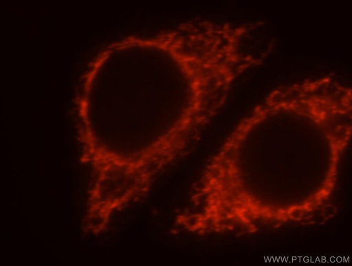 [15913-1-AP-150UL] MRPL38 Polyclonal antibody