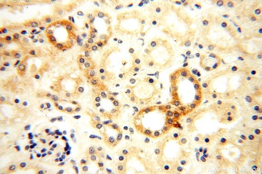 [15916-1-AP-20UL] Semenogelin-1 Polyclonal antibody