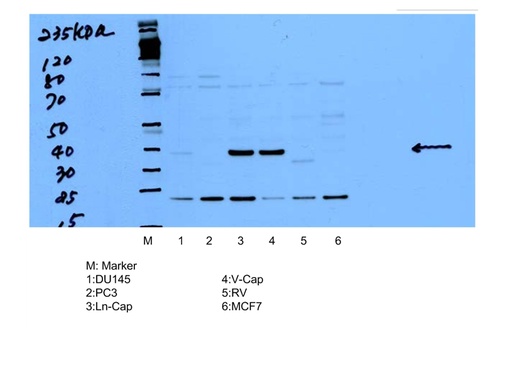 [15918-1-AP-150UL] AMACR/p504S Polyclonal antibody