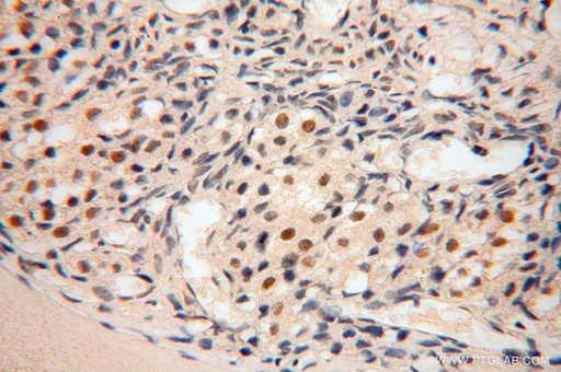 [15923-1-AP-150UL] POLR1C Polyclonal antibody