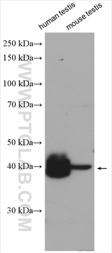 [15930-1-AP-150UL] ART3 Polyclonal antibody