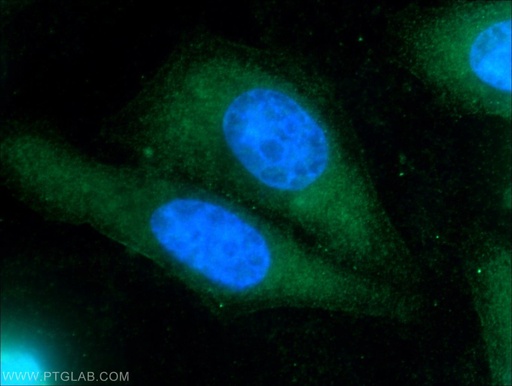 [15940-1-AP-20UL] TIPE2 Polyclonal antibody