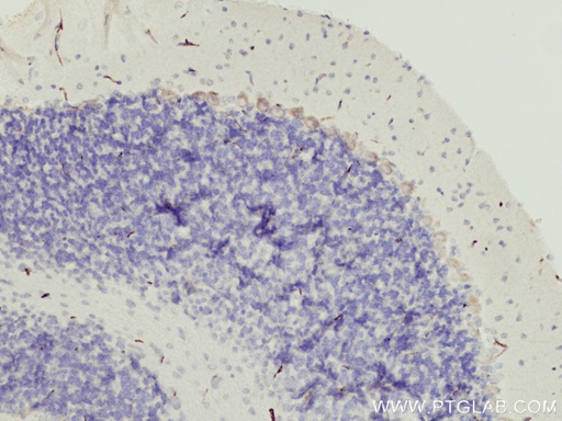 [15941-1-AP-20UL] TMEM50B Polyclonal antibody