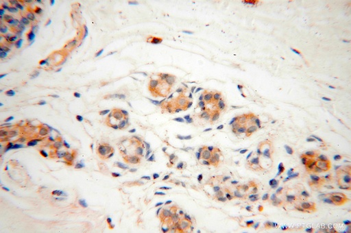 [15948-1-AP-150UL] CAPZA2 Polyclonal antibody