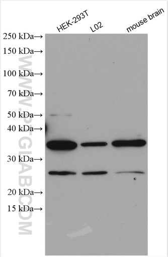 [15949-1-AP-20UL] DYNC2LI1 Polyclonal antibody