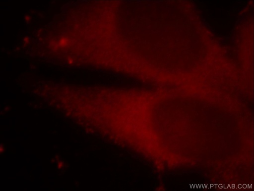 [15952-1-AP-150UL] MAT2B Polyclonal antibody