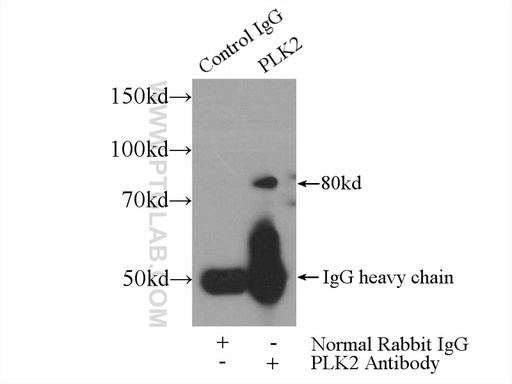 [15956-1-AP-150UL] PLK2 Polyclonal antibody