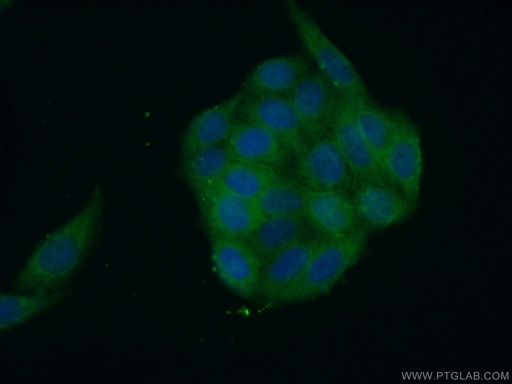 [15957-1-AP-150UL] SH2D4A Polyclonal antibody