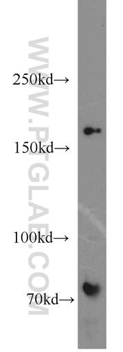 [15961-1-AP-150UL] MBD5 Polyclonal antibody