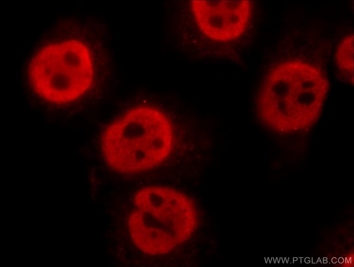 [15968-1-AP-150UL] FIBP Polyclonal antibody