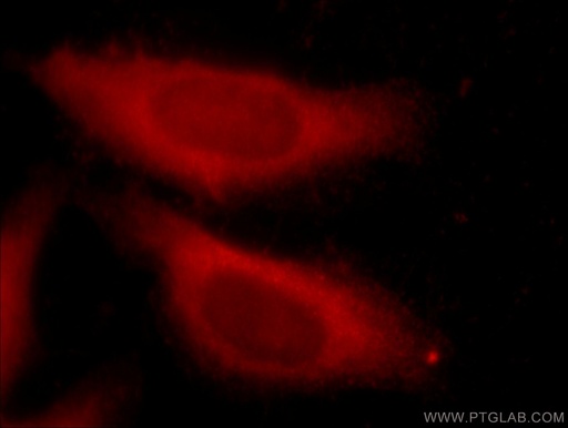 [15969-1-AP-20UL] SDCCAG3 Polyclonal antibody