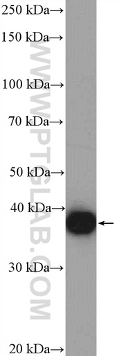[15973-1-AP-20UL] EBP2 Polyclonal antibody