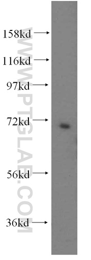 [15978-1-AP-150UL] PAPSS2 Polyclonal antibody