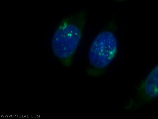[15983-1-AP-20UL] PSMB3 Polyclonal antibody