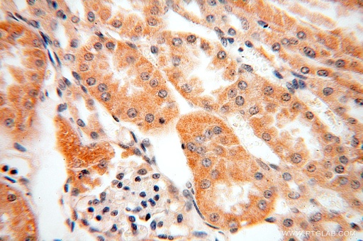 [15985-1-AP-150UL] SFXN2 Polyclonal antibody